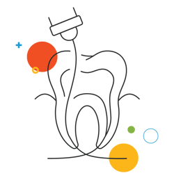 Endodontics-Illustration