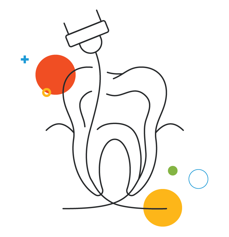 Endodontics-Illustration Endodontics-Illustration